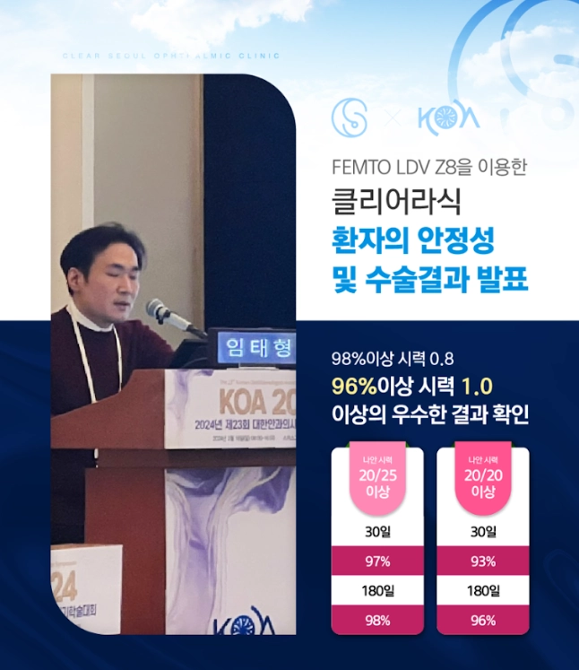 강남 스마일라식 라섹 차이 스마일라식 잘 하는 안과