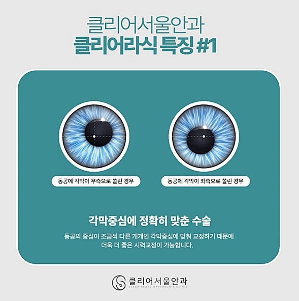 스마일라식 잘 하는 안과 강남역 클리어서울안과