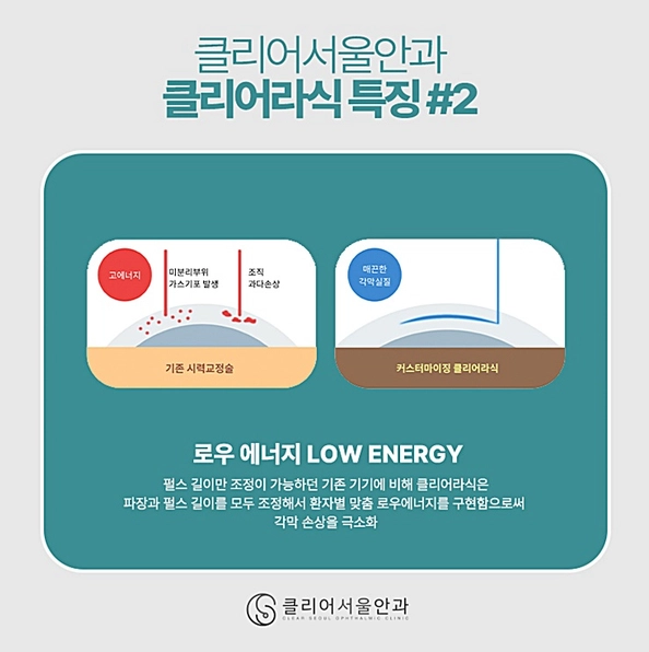 스마일라식 잘 하는 안과 강남역 클리어서울안과